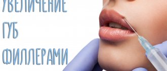 Lip fillers – which one is better?