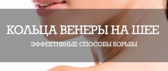 Как убрать кольца Венеры на шее