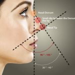 Правильное соотношение носа к лицу и углы используемые пластическими хирургами